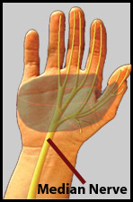 Palm Swell Median Nerve